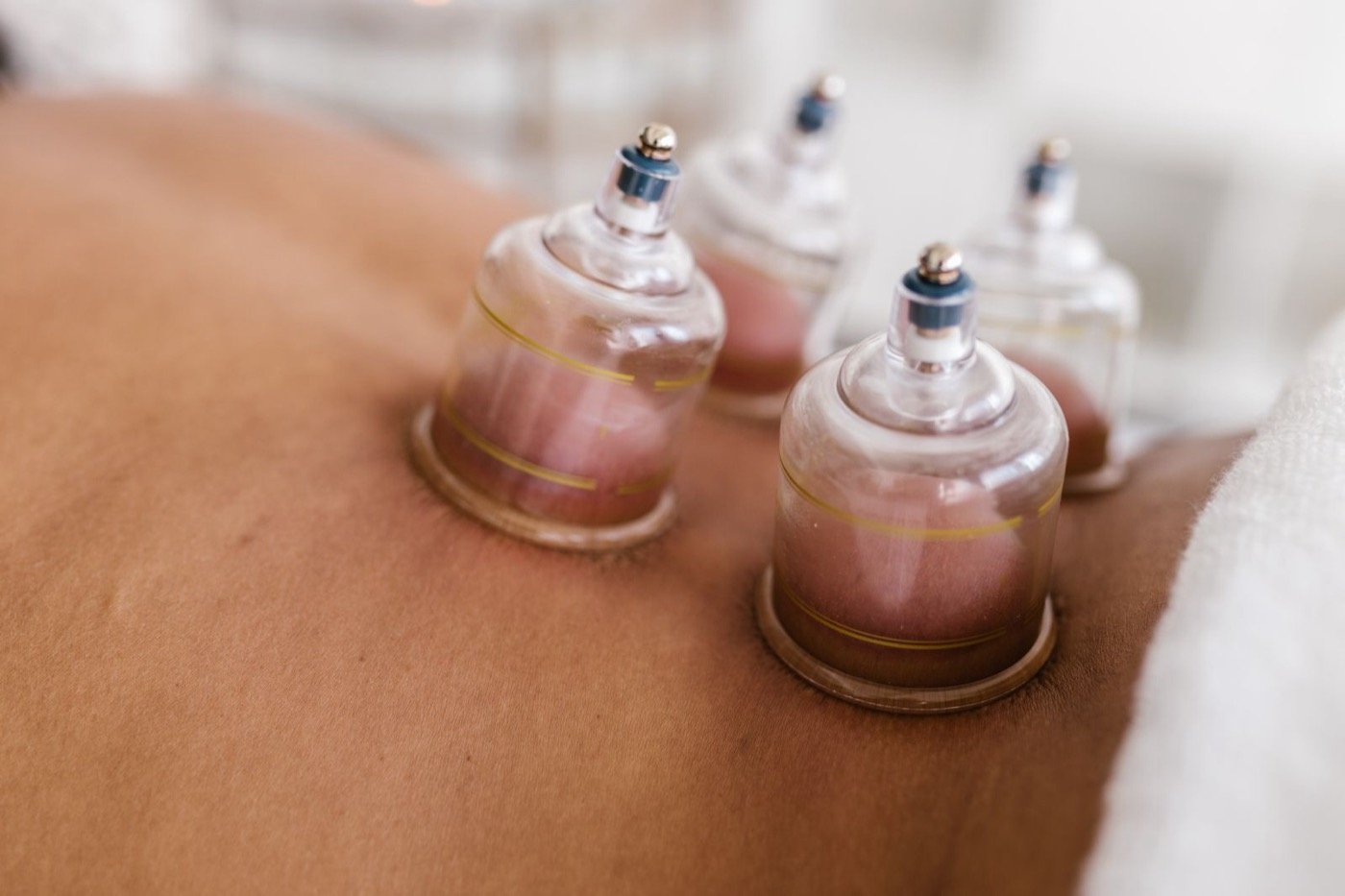 Cupping Massage detail